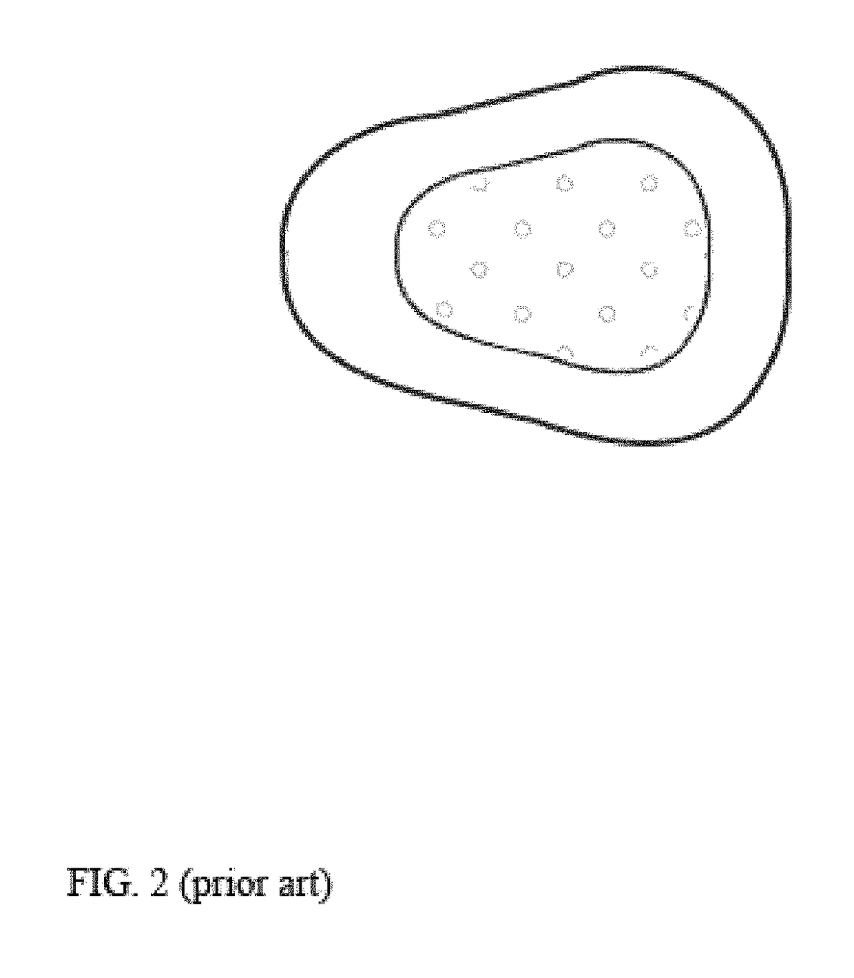 Tarsus eyelid patch