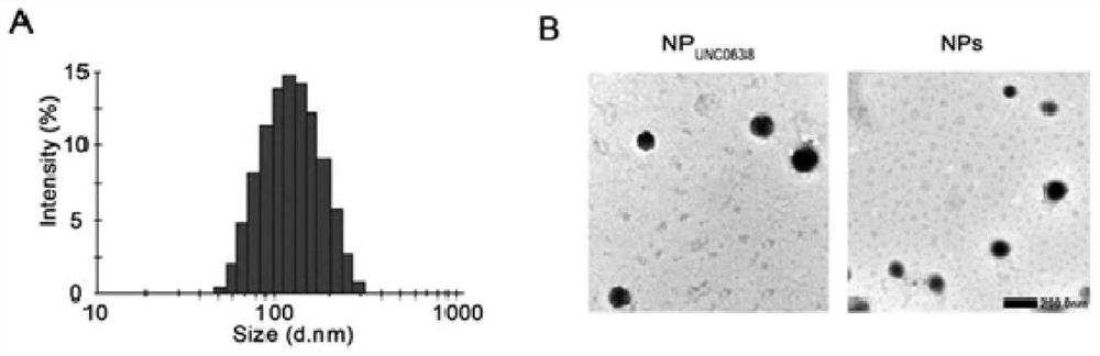Nano-drug and preparation method thereof, and application of nano-drug in treatment of pancreatic ductal carcinoma