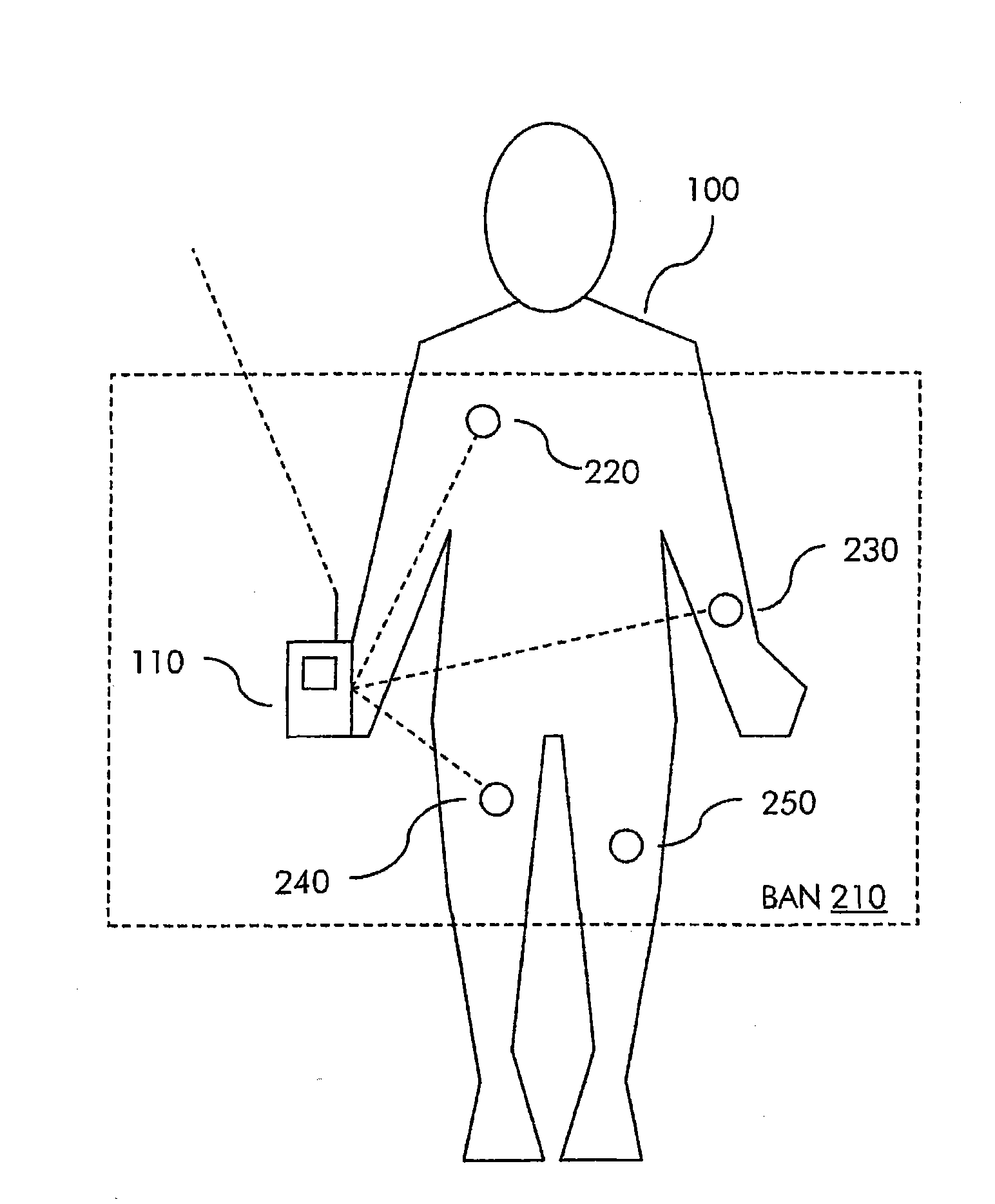 Method and system for self-monitoring of environment-related respiratory ailments