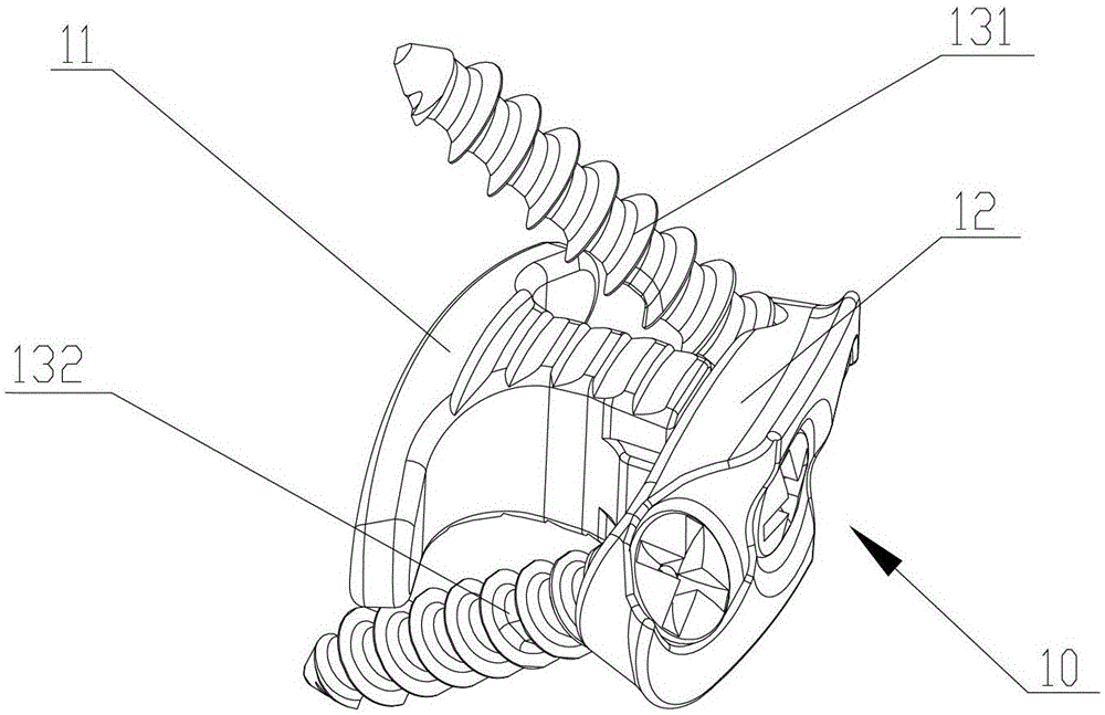 Intervertebral space fusion device and pusher for advancing it