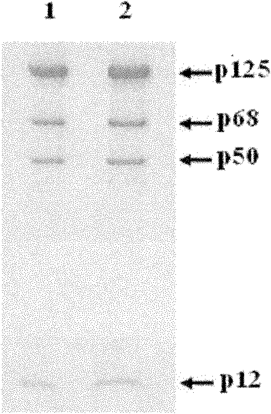 Method for preparing human DNA polymerase delta by using bombyx mori bioreactor