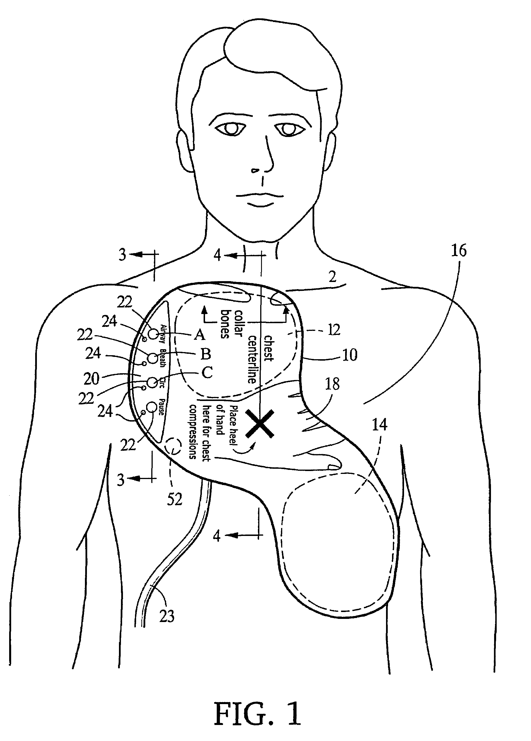Integrated resuscitation
