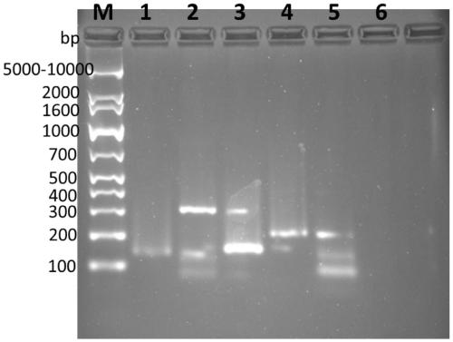 Fast detection method of ureaplasma urealyticum based on RPA