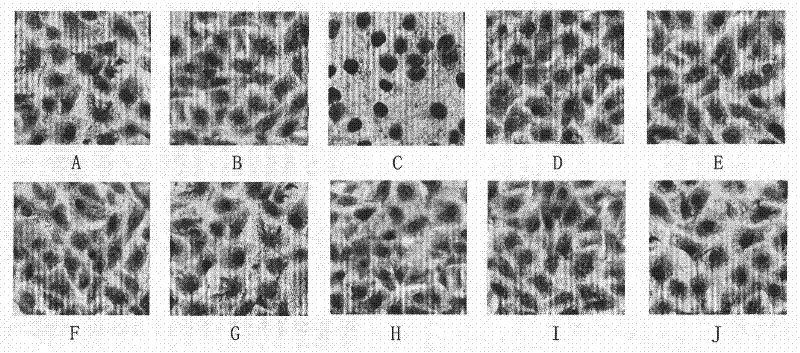 Medicinal composition for preventing and treating vascular injury caused by organic phosphorous pesticide and preparation method thereof