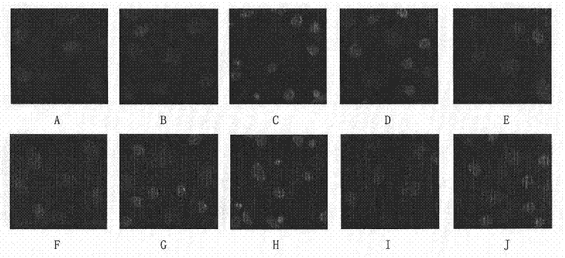 Medicinal composition for preventing and treating vascular injury caused by organic phosphorous pesticide and preparation method thereof