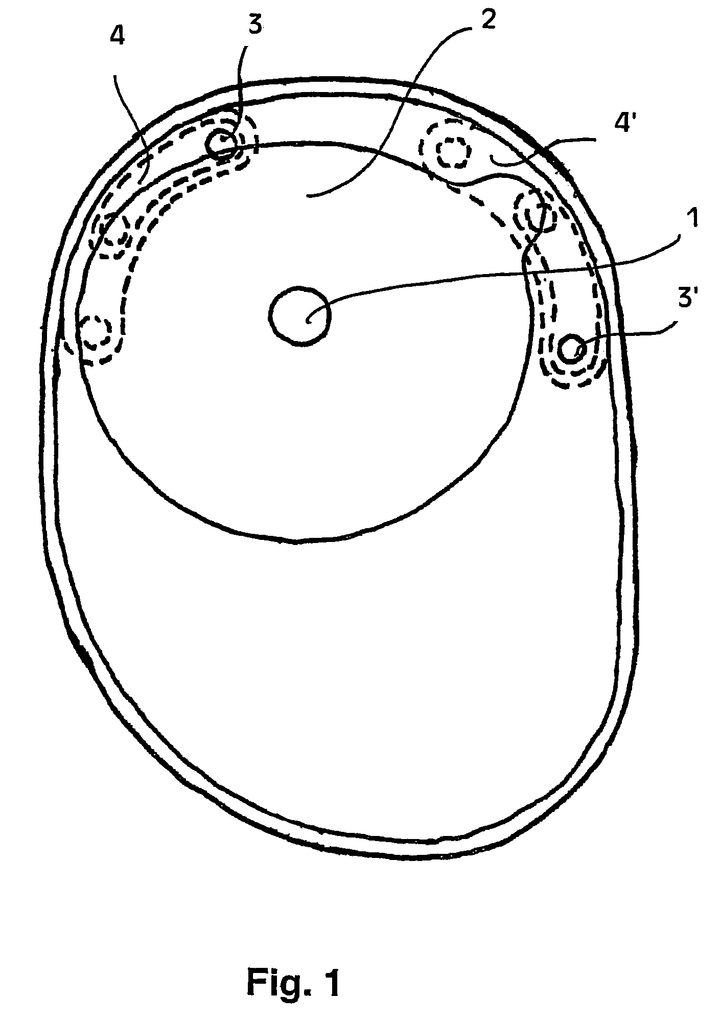 Ostomy appliance with multiple openings for preventing filter input blockage