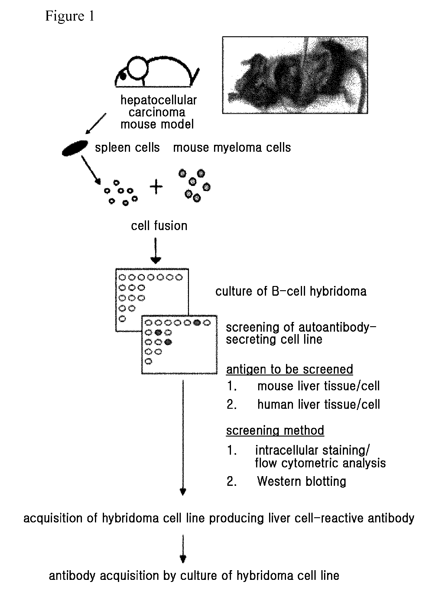 Diagnostic marker for hepatocellular carcinoma comprising anti-FASN autoantibodies and a diagnostic composition for hepatocellular carcinoma comprising antigens thereof