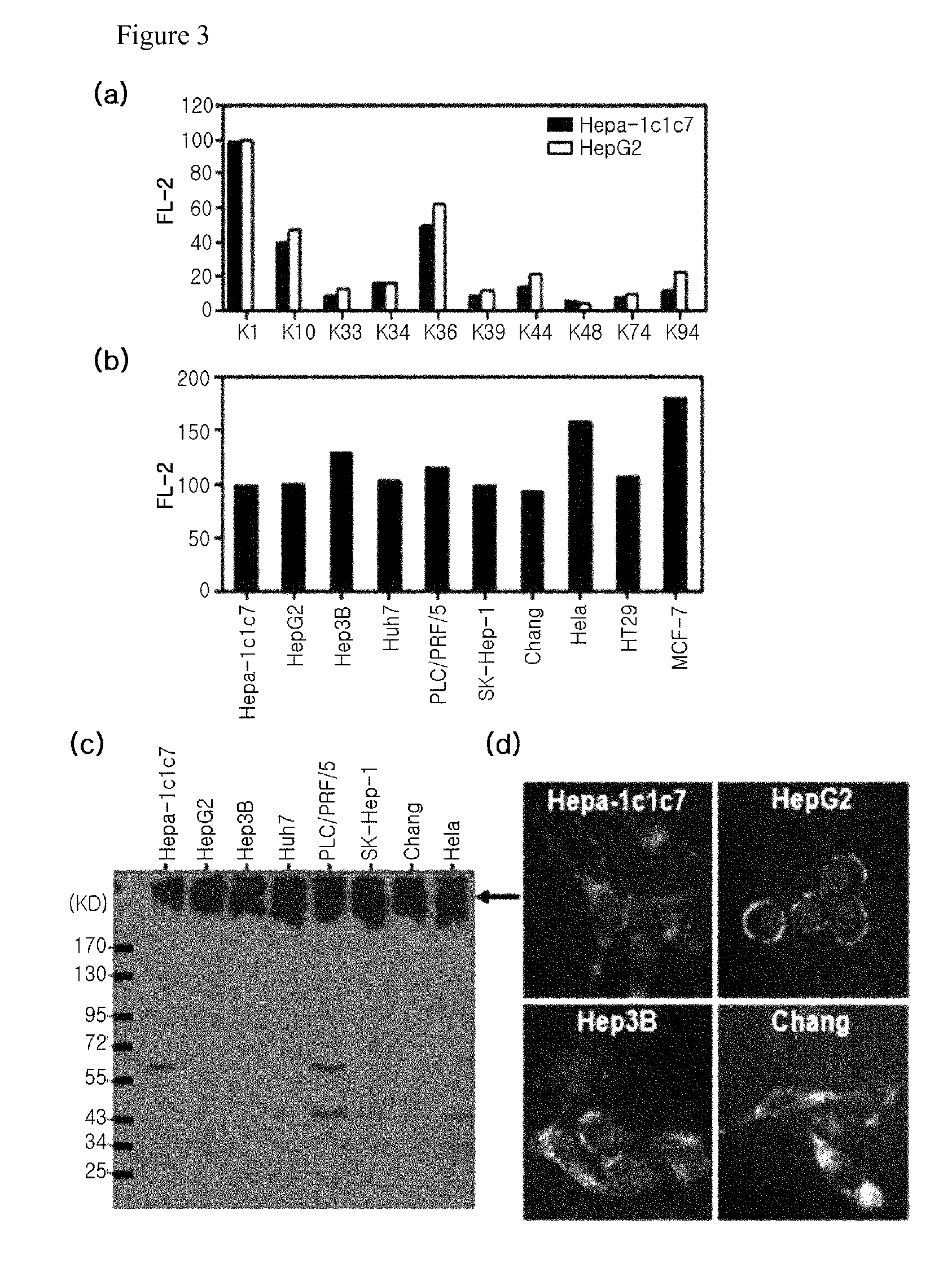 Diagnostic marker for hepatocellular carcinoma comprising anti-FASN autoantibodies and a diagnostic composition for hepatocellular carcinoma comprising antigens thereof