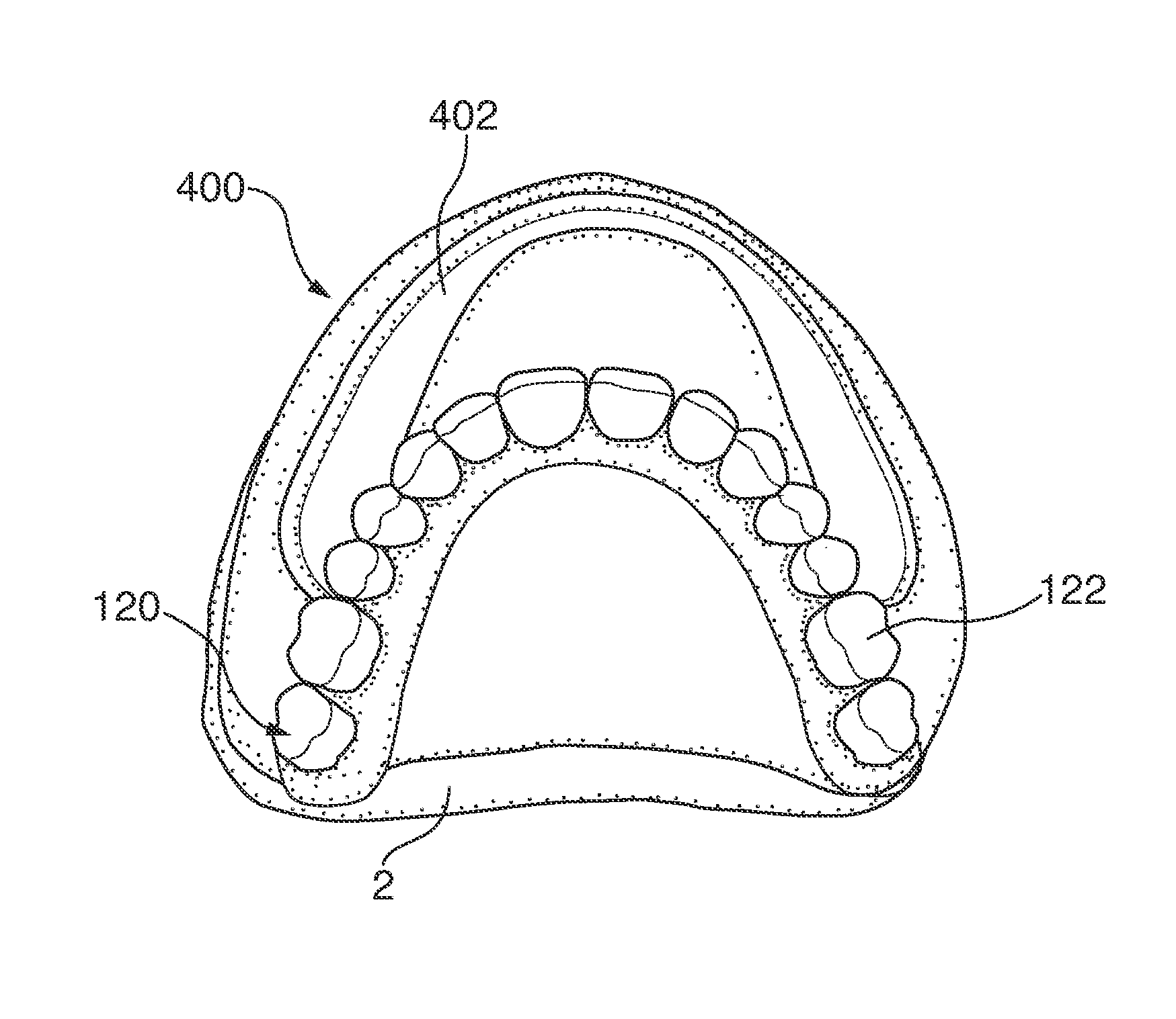 Dental devices and systems and methods for making the same