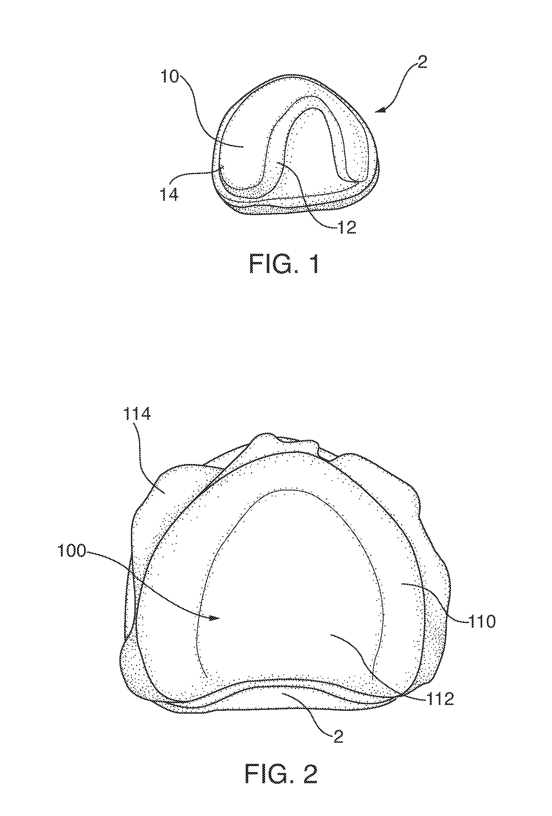Dental devices and systems and methods for making the same