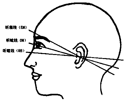 A method for correcting head position in head CT image