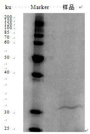 Lactobacillus paracasei ALAC-4 and bacterium restraining application thereof