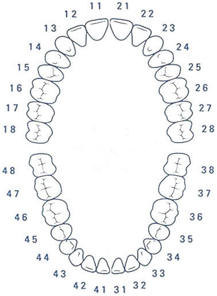 Tooth correctional system suitable for mixed dentition and manufacturing method