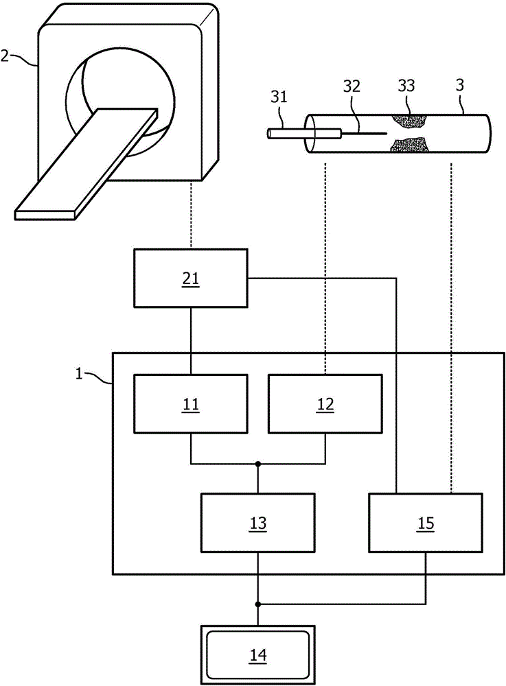 Processing apparatus and method for processing cardiac data of a living being