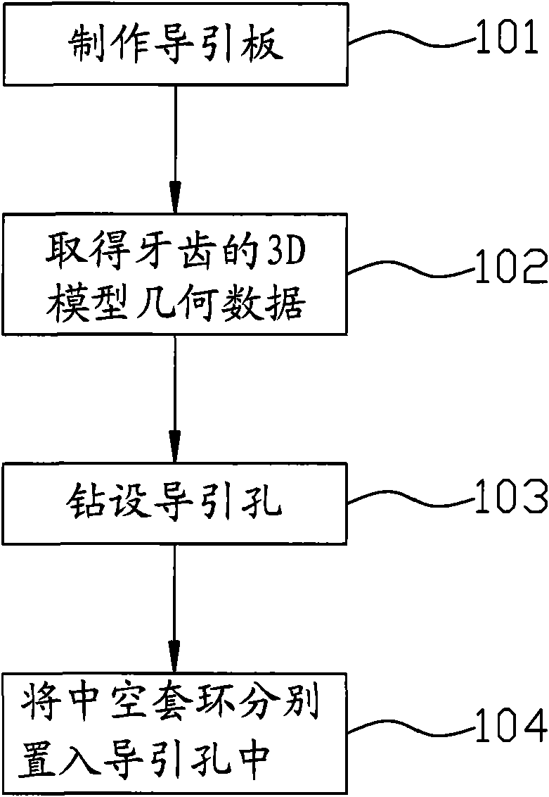 Method for producing tooth implantation surgical guide stent