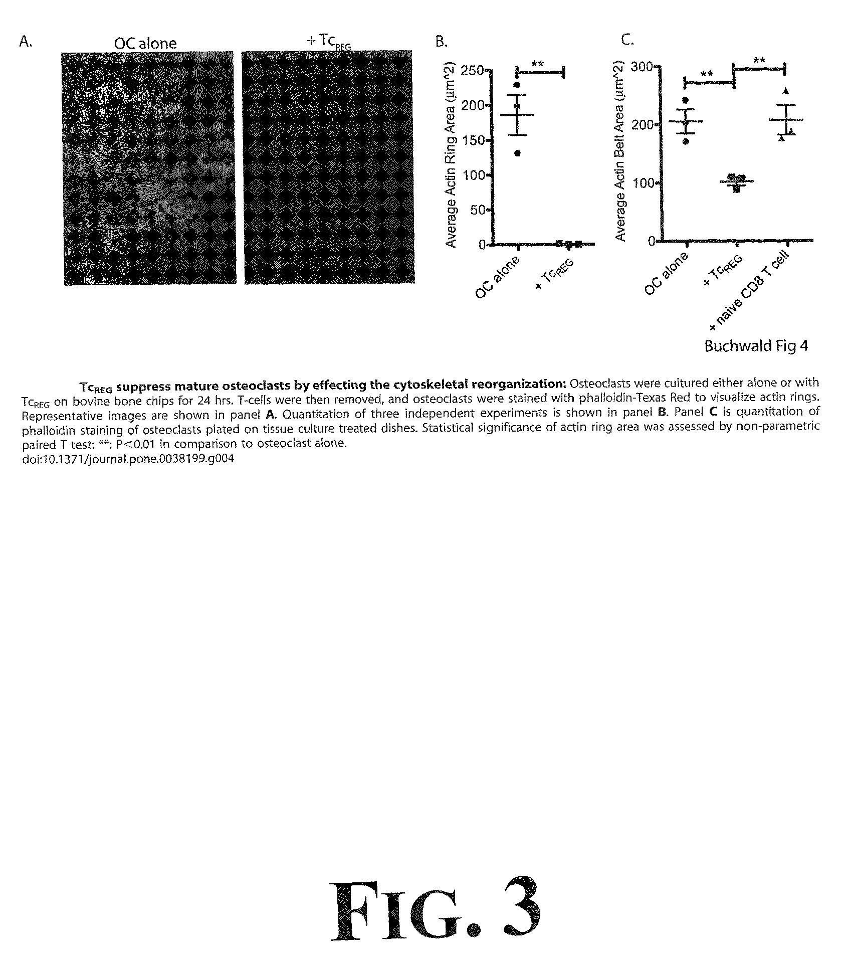 Suppression of bone loss by introducing FoxP3+ CD8 T-cells (Tc<sub>REG</sub>)