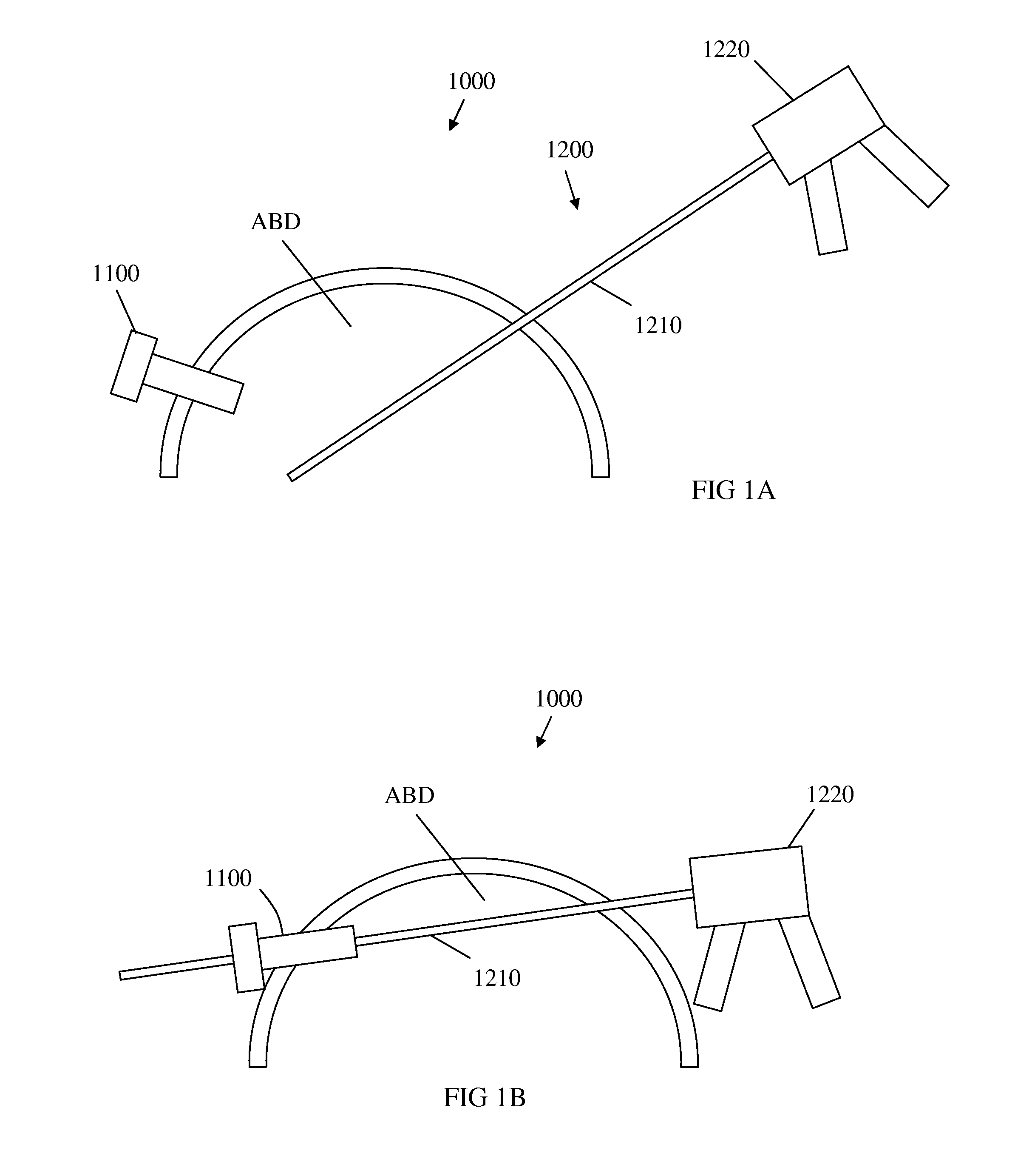 Micro laparoscopy devices and deployments thereof