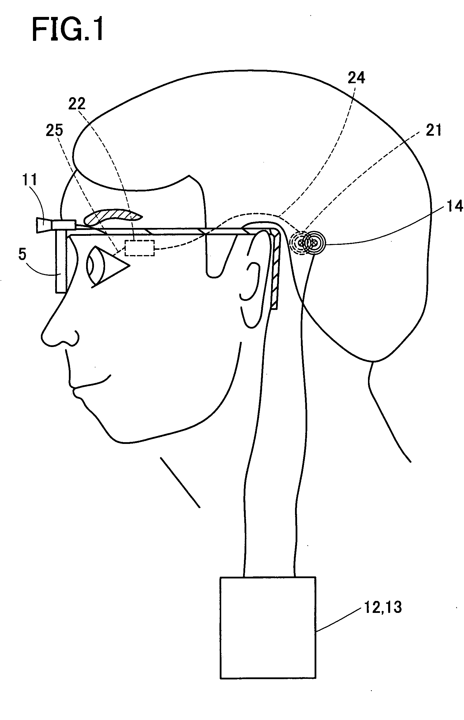 Artificail vision system