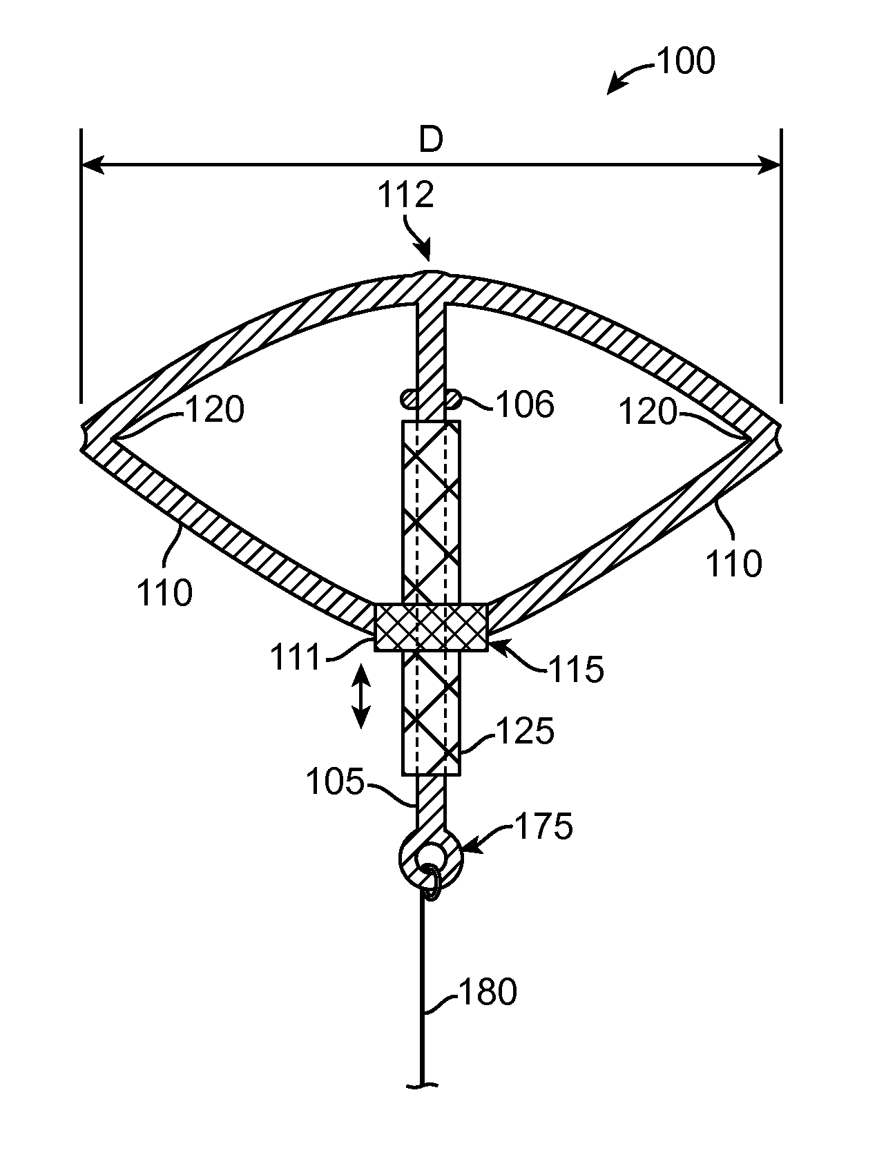 Intra-uterine device and related methods
