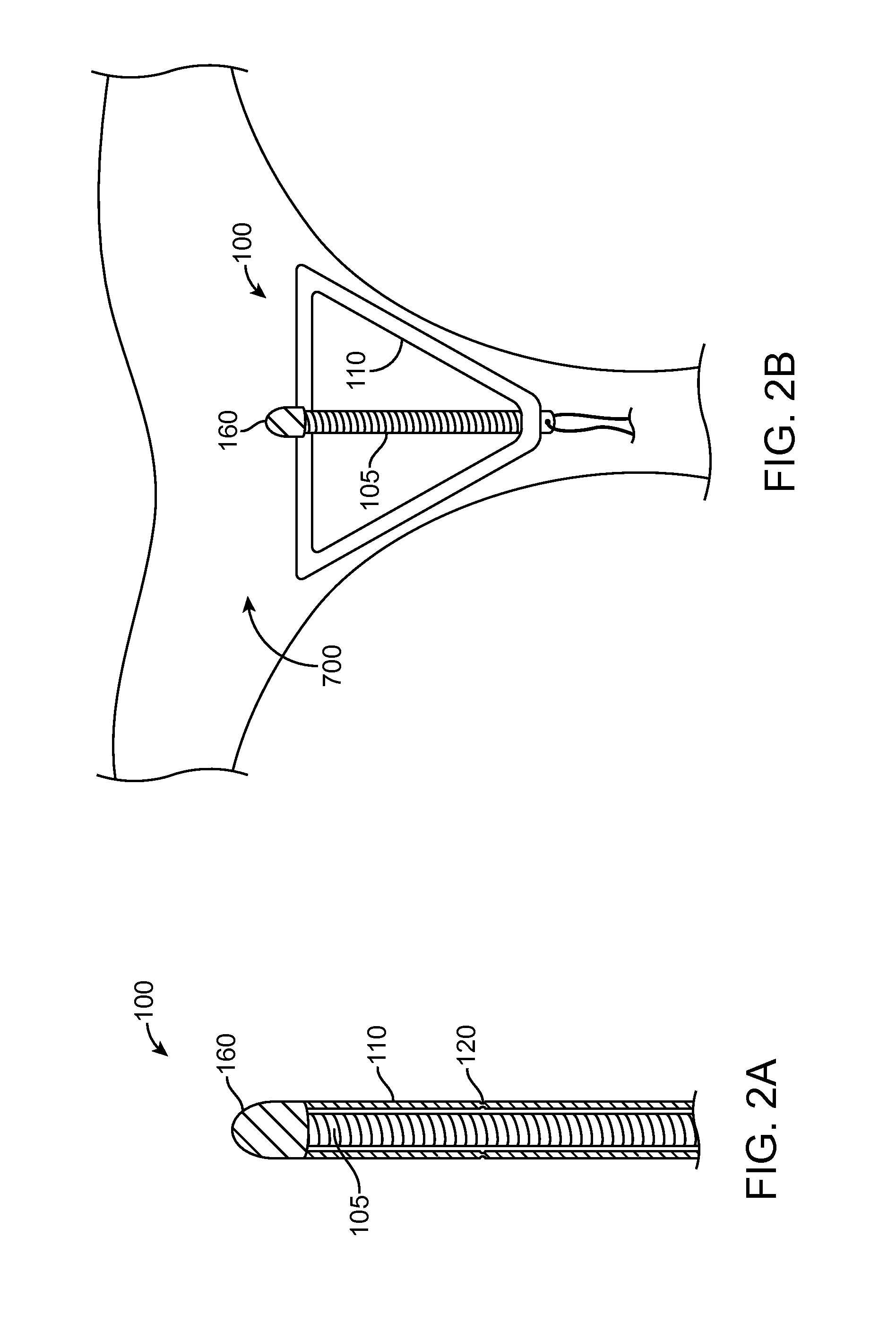 Intra-uterine device and related methods