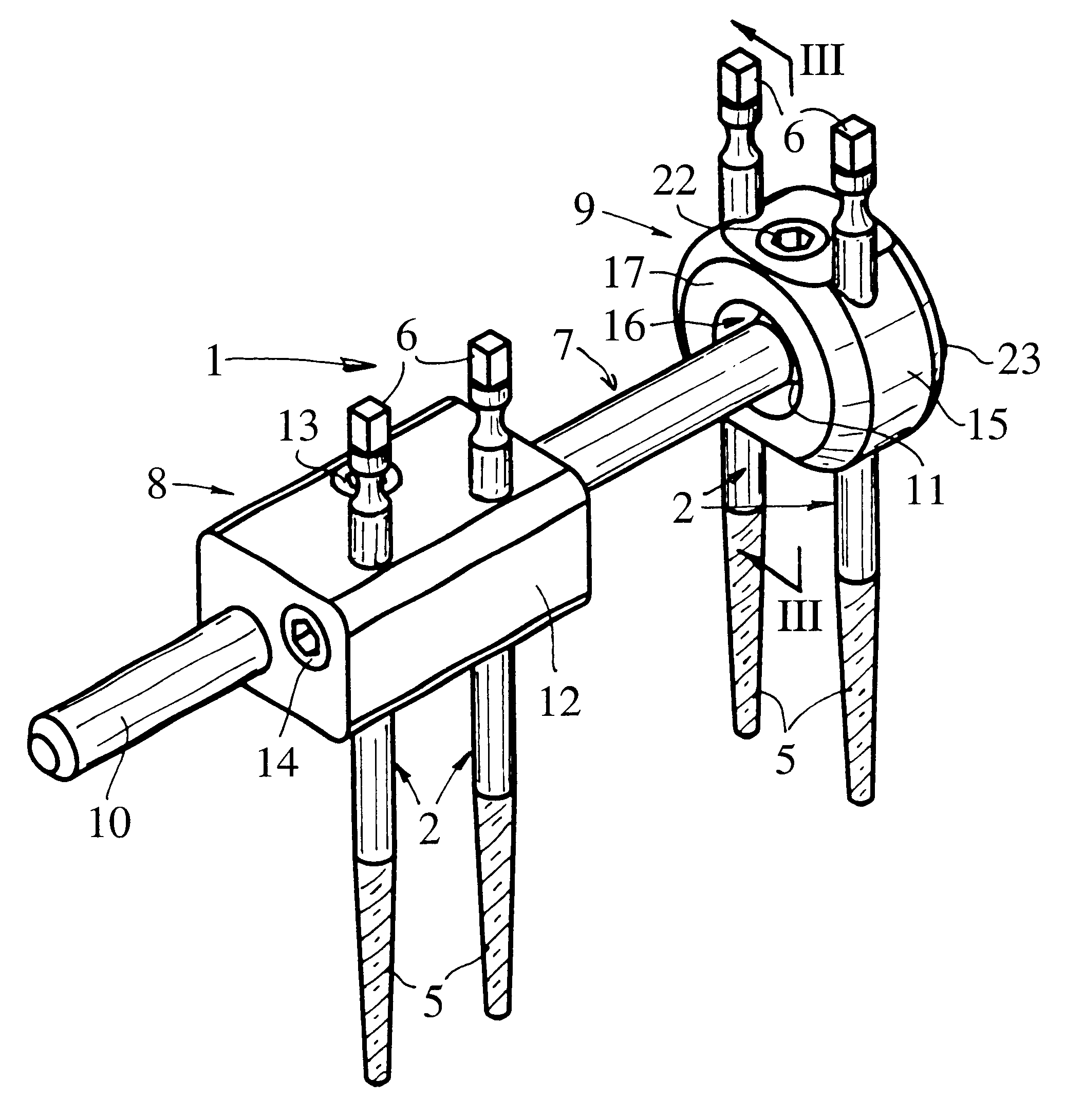 External fixator for immobilizing bone fragments, particularly in the area of the wrist