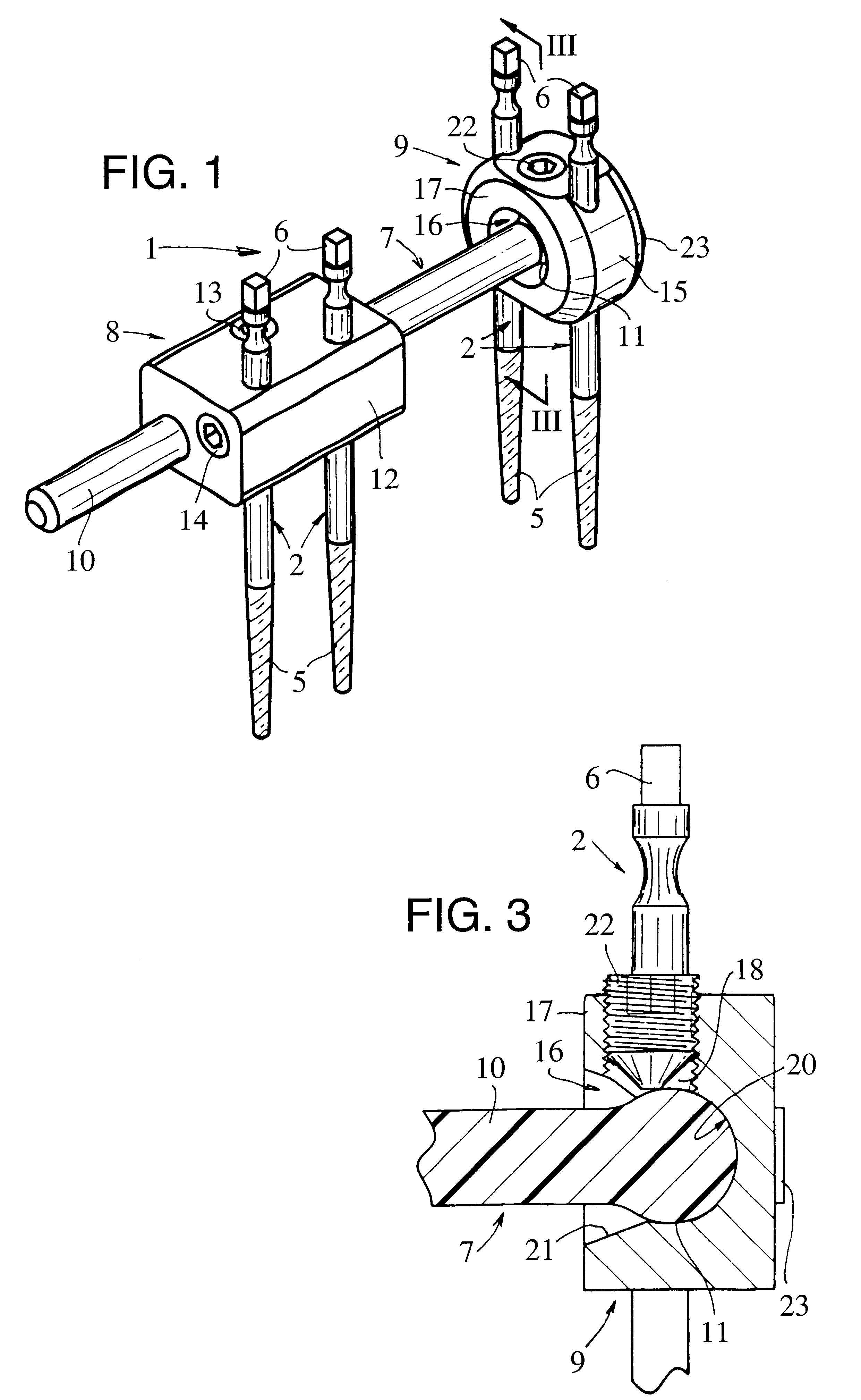 External fixator for immobilizing bone fragments, particularly in the area of the wrist