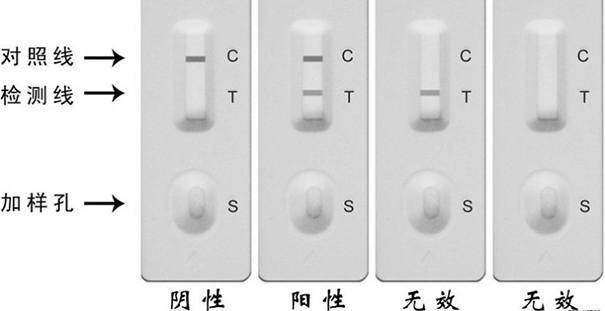 Amplification primer composition and kit for detecting novel coronavirus