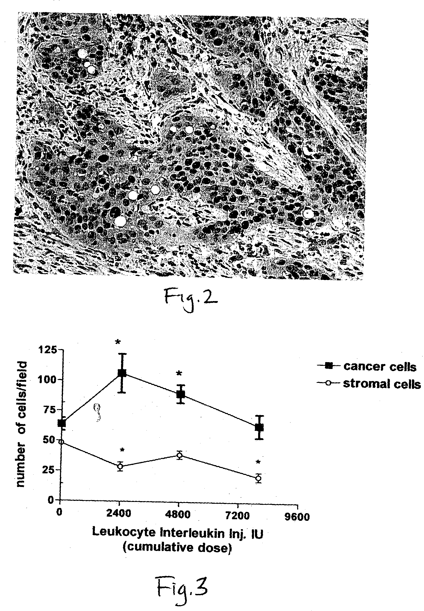 Method of pre-sensitizing cancer prior to treatment with radiation and/or chemotherapy and a novel cytokine mixture