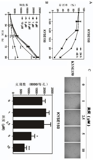 Application of ebiprazole in the preparation of antineoplastic drugs