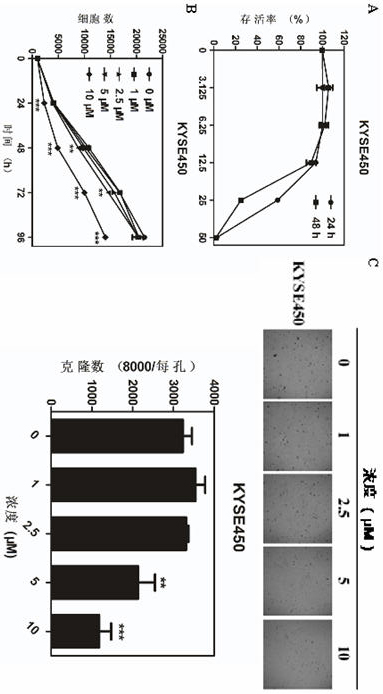 Application of ebiprazole in the preparation of antineoplastic drugs