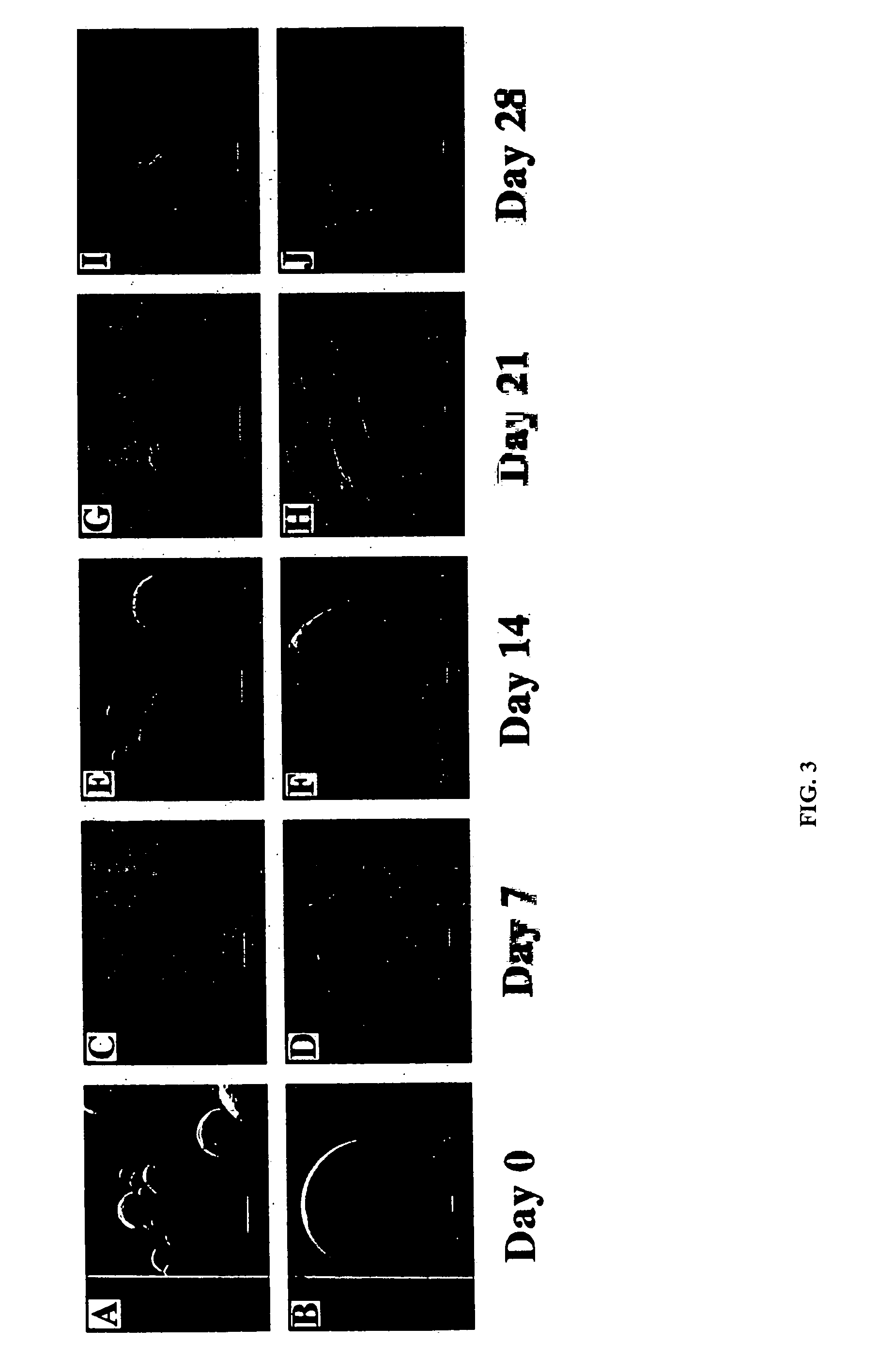 Compositions and methods for biodegradable microspheres as carriers of bioactive substances