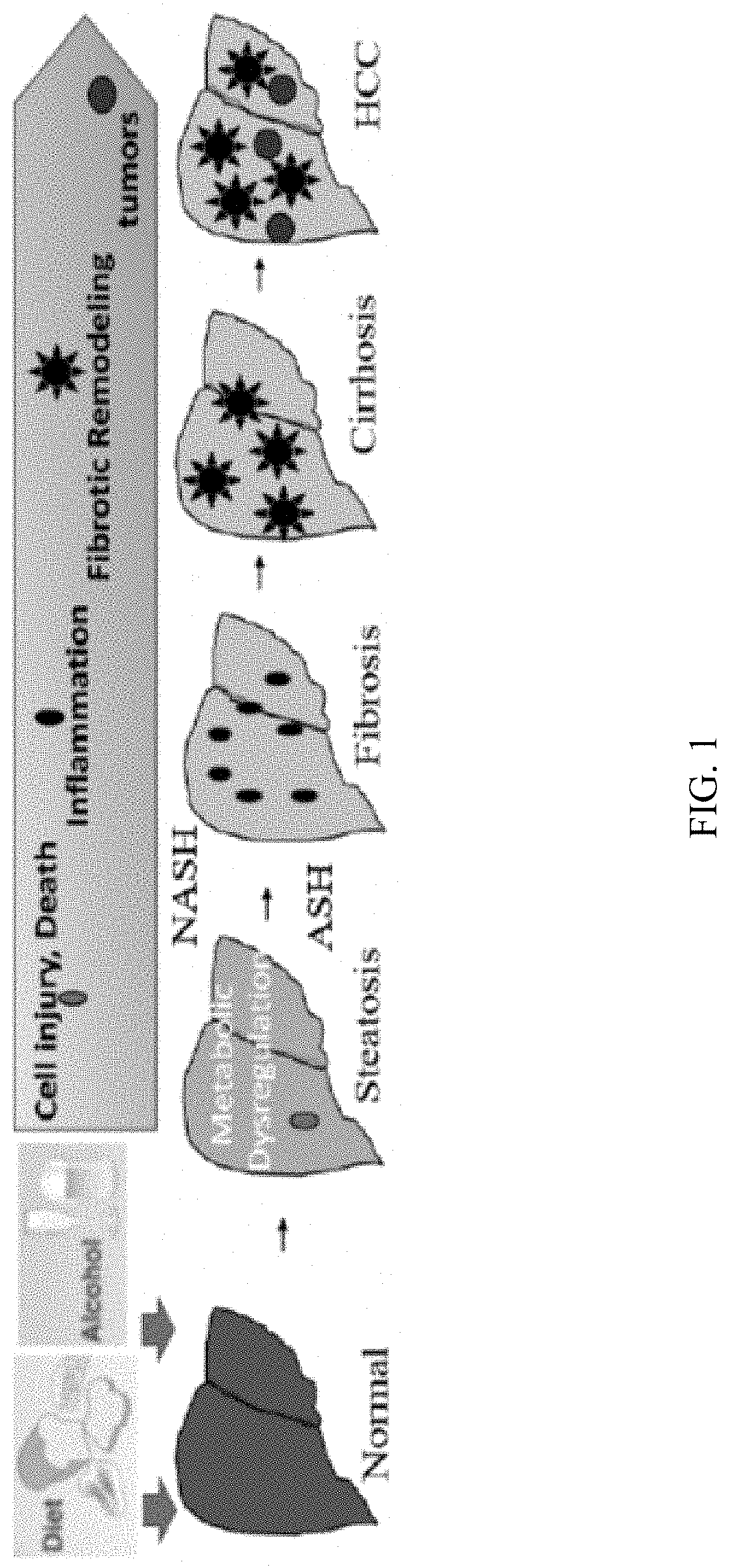 Mouse Model of Alcohol-induced Liver Cancer