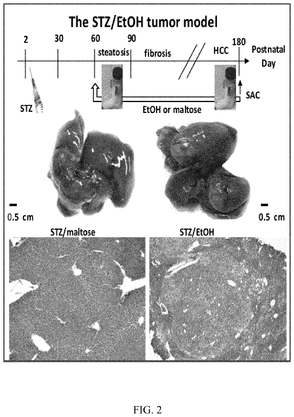 Mouse Model of Alcohol-induced Liver Cancer