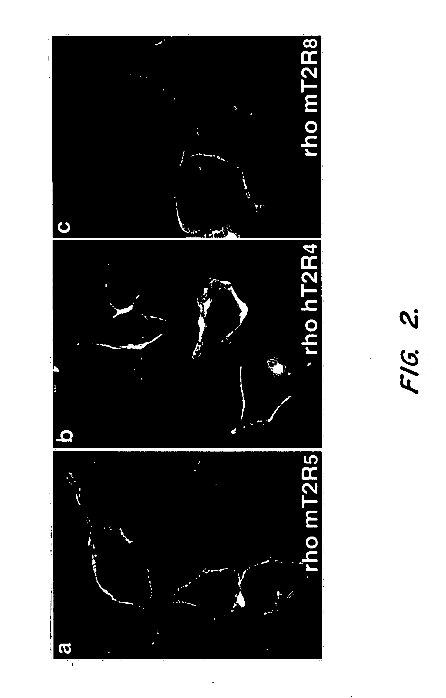 T2R, a novel family of taste receptors