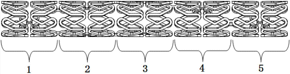 Complex support rib vascular stent