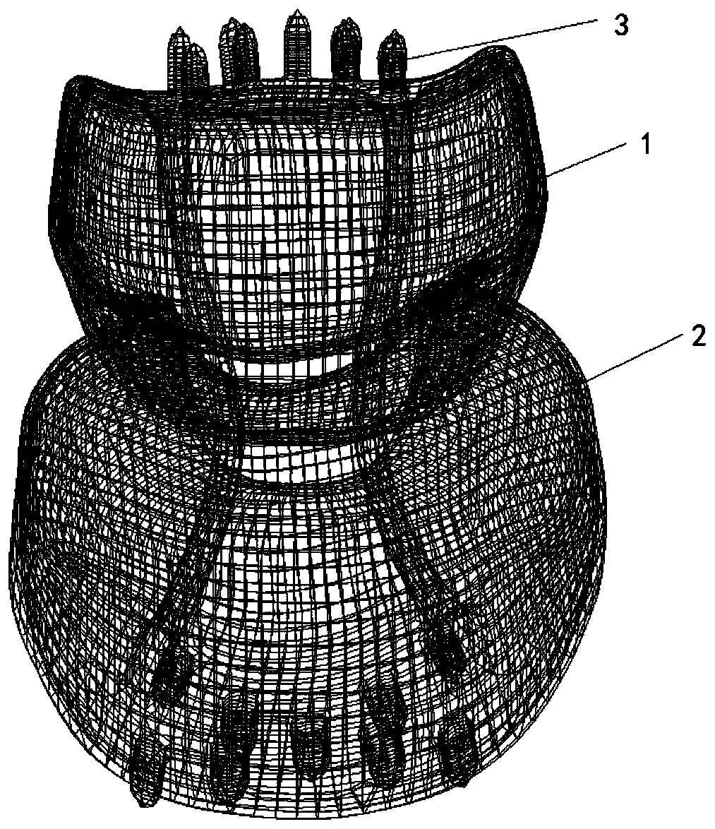 3D-printed cervical total spondylectomy implantable prosthetic device