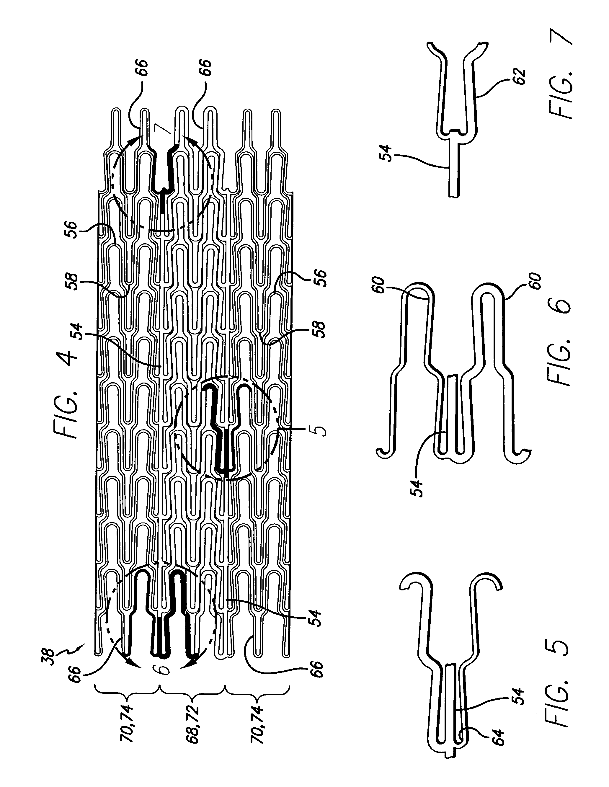 Intravascular stent for treating vulnerable plaque and method of use