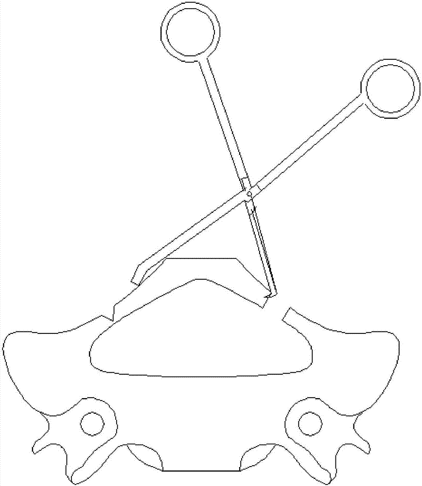 Vertebral plate-rotating opener for cervical vertebra single-door opening operation