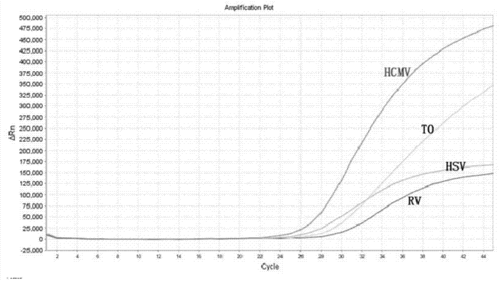 Polymerase chain reaction (PCR) method for identifying four pathogens in prenatal and postnatal care examination through single tube and kit thereof