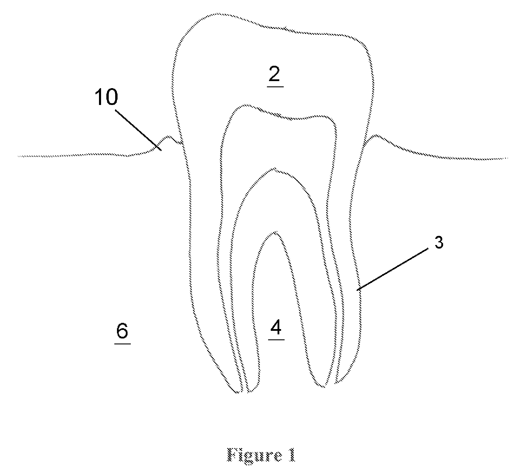 Method For Treating Periodontal Disease