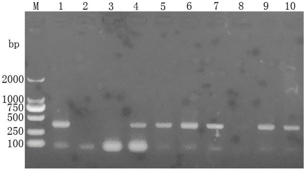 Detection kit and detection method of mandarin fish rhabdovirus