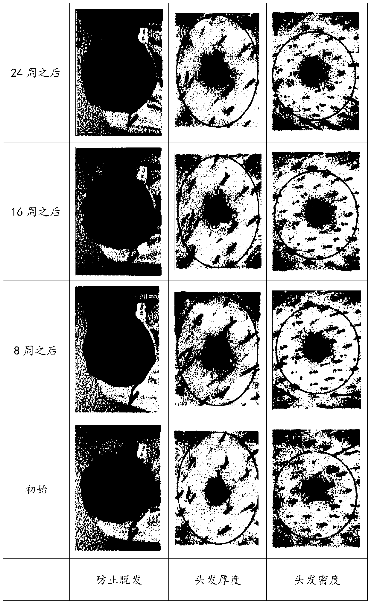 Cosmetic composition having effects of preventing and alleviating scalp aging and preventing hair loss