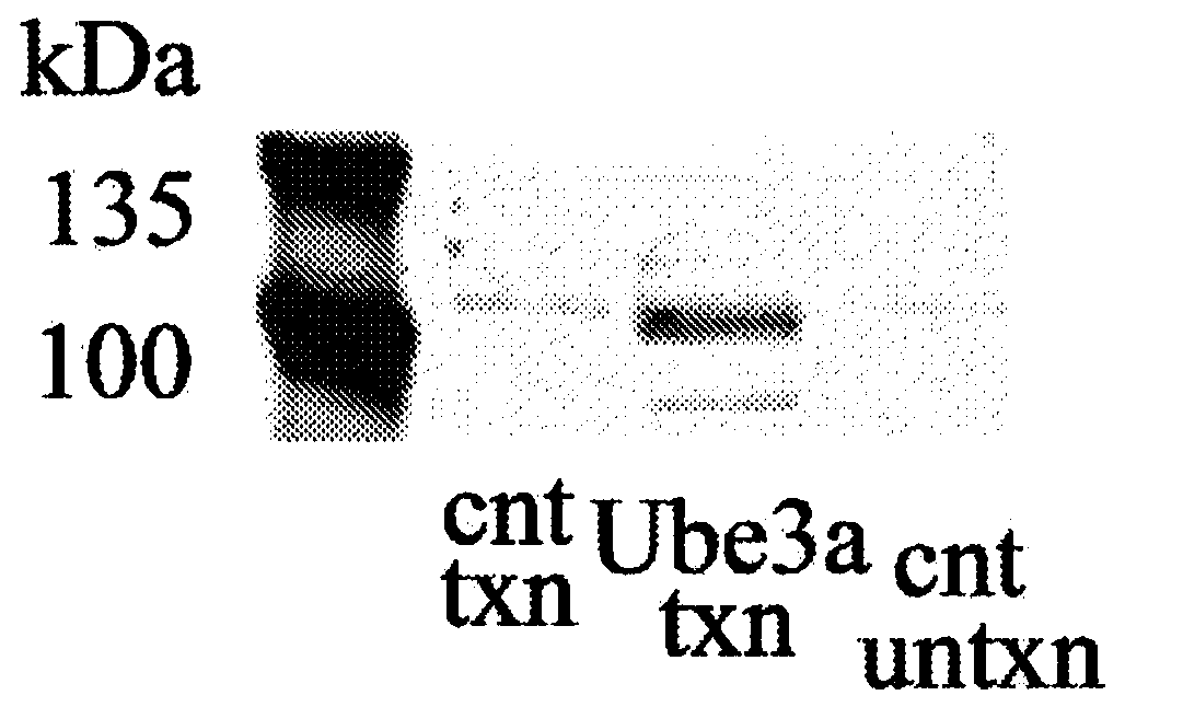 Modified ube3a gene for a gene therapy approach for angelman syndrome