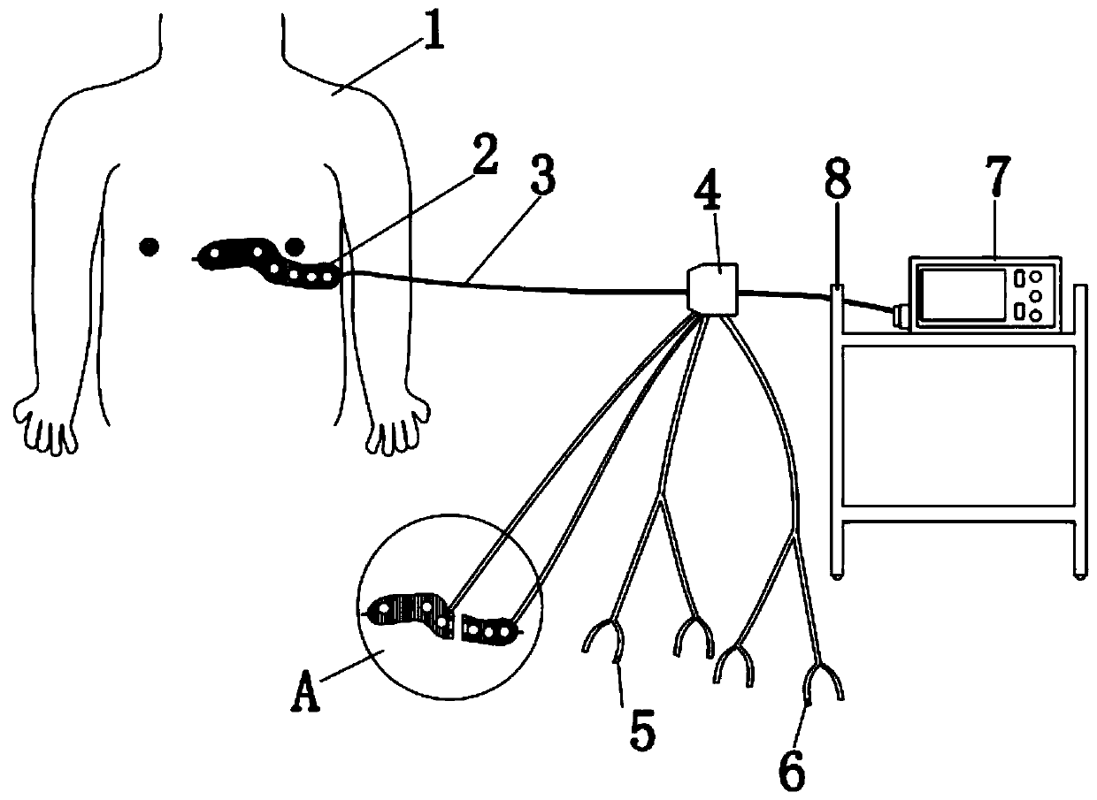 Novel electrocardiograph lead structure