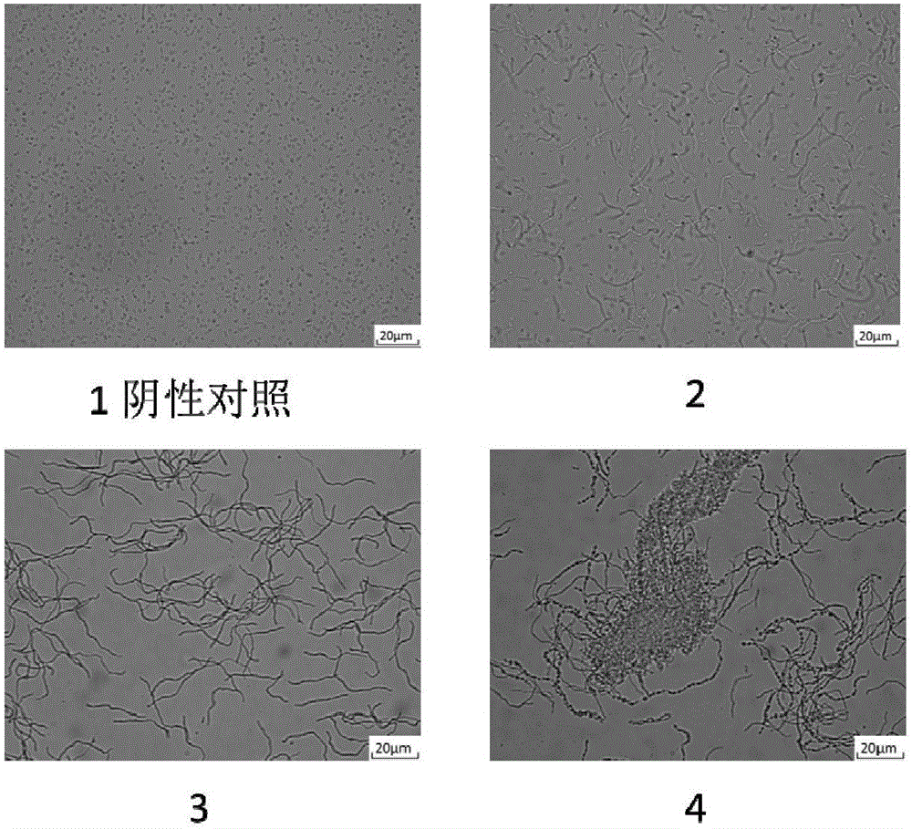 System for inducing foreign genes to express in gram-negative bacteria and application of system