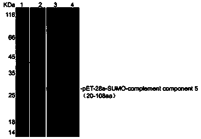 Preparing method of grass carp complement 5 polyclonal antibody