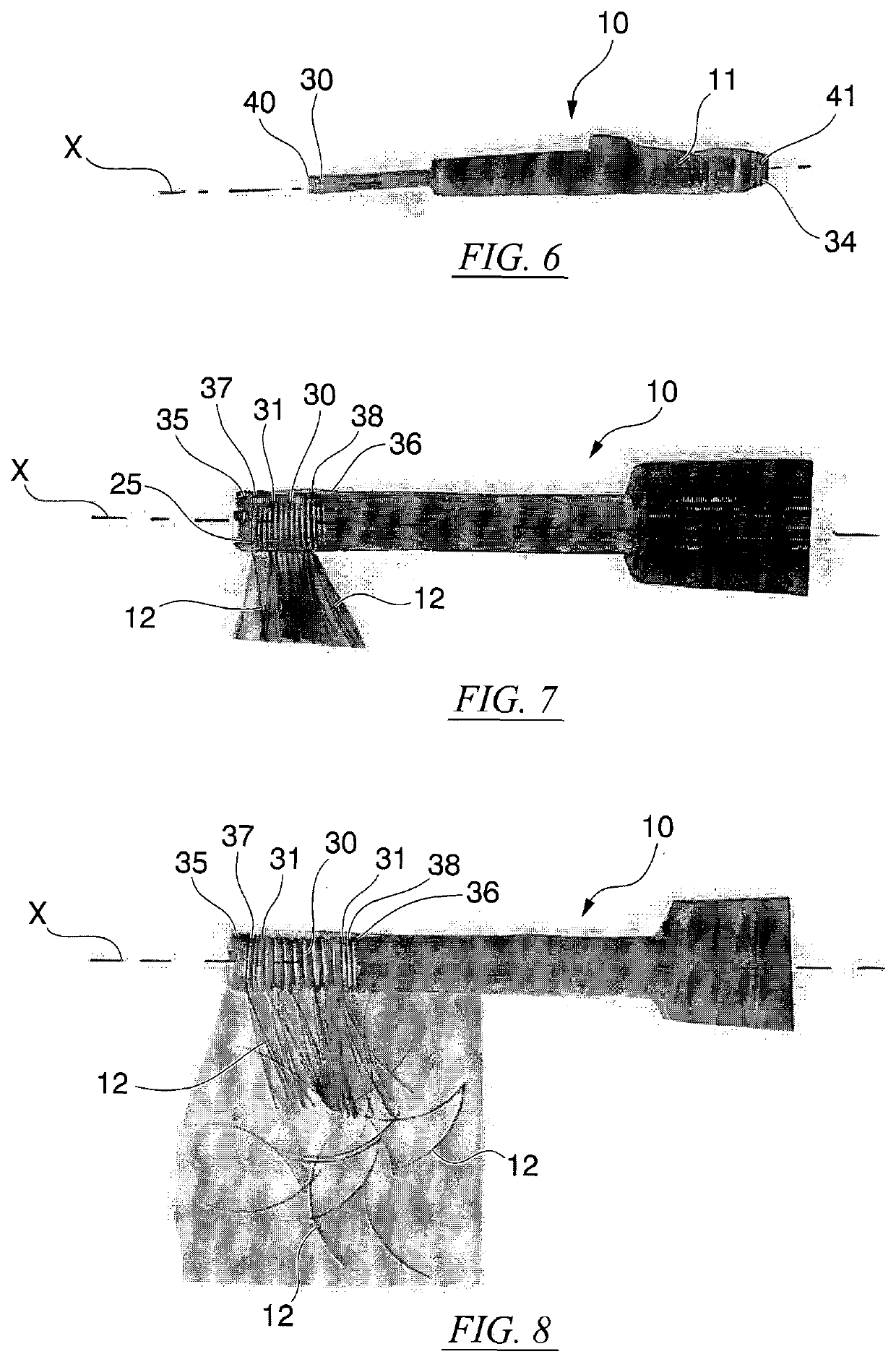 Cosmetic treatment method and assembly