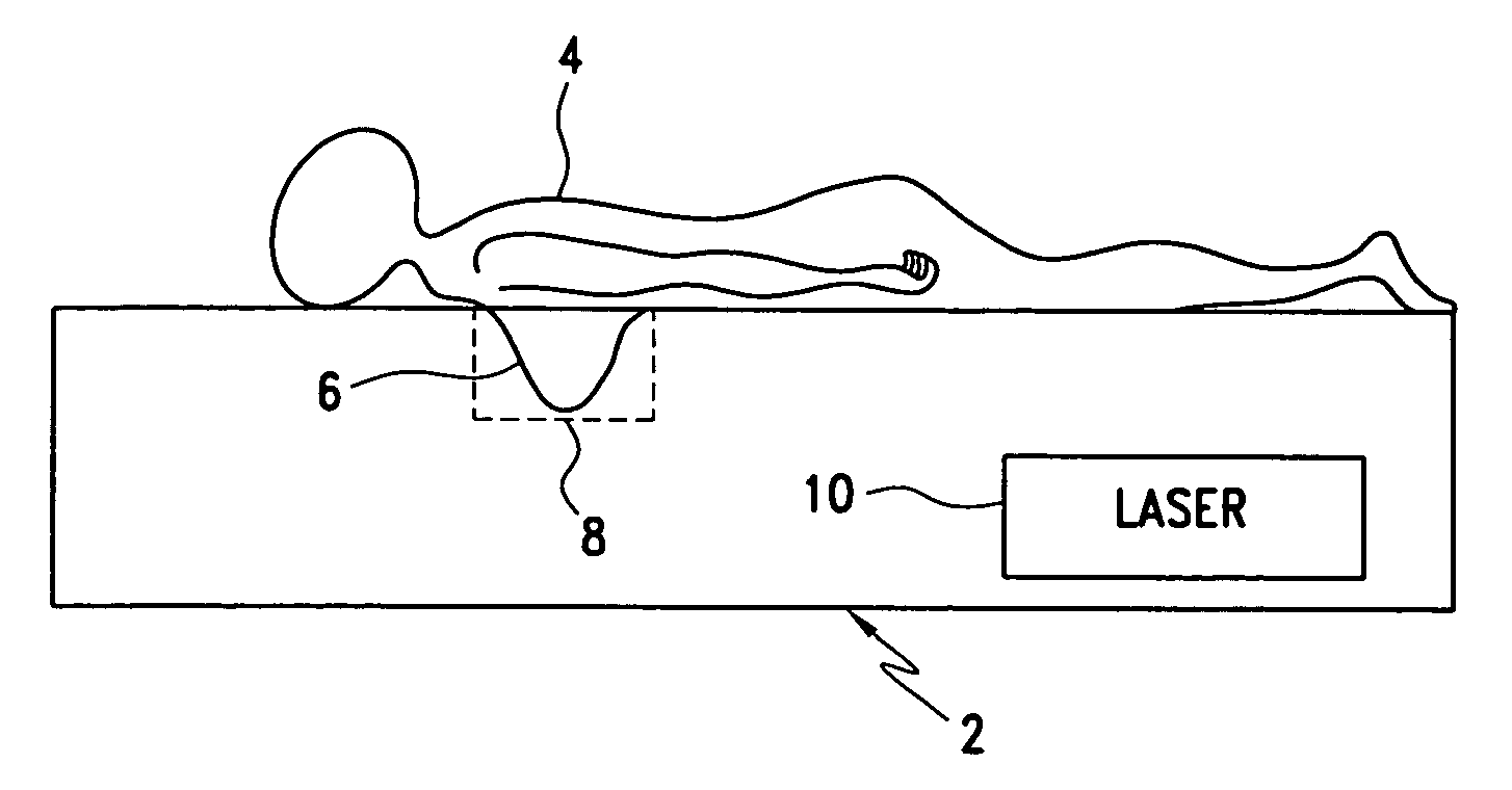 Laser imaging apparatus with variable power, orbit time and beam diameter