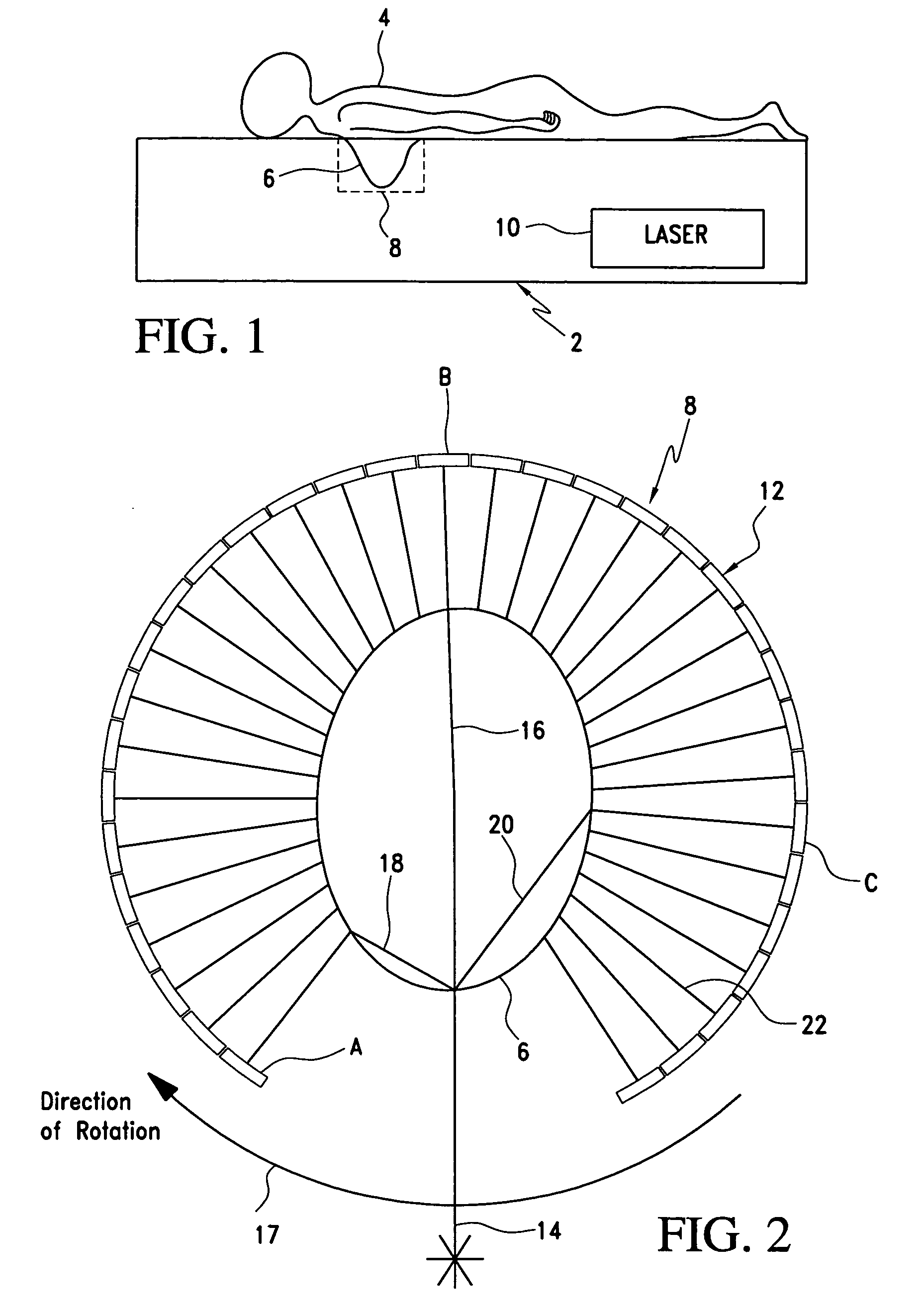 Laser imaging apparatus with variable power, orbit time and beam diameter