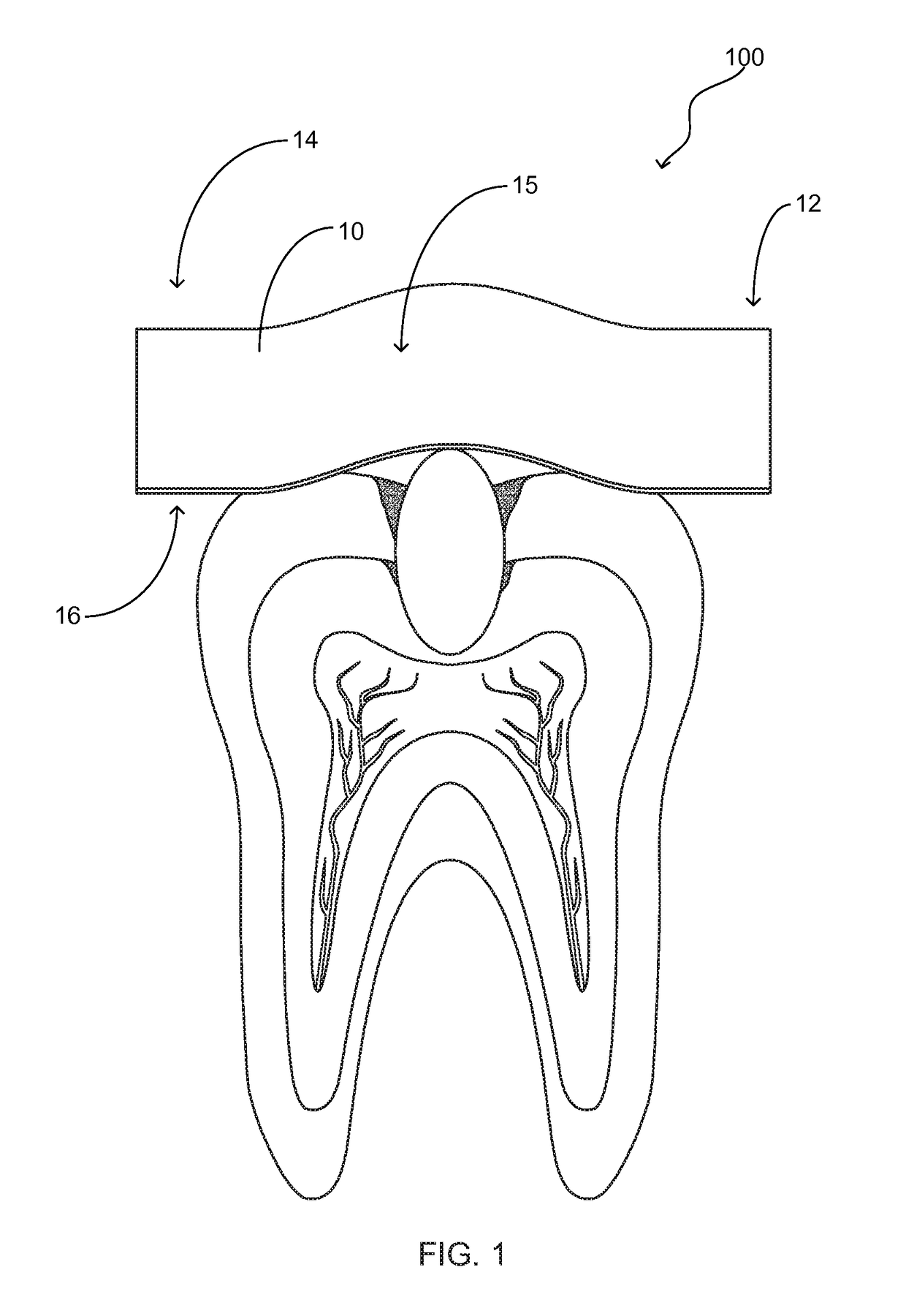 Tooth protection device